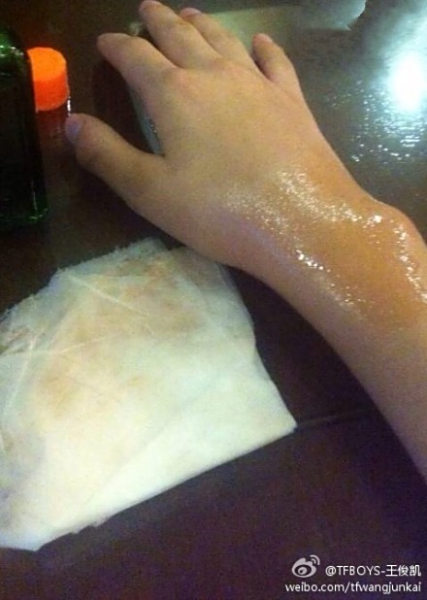 米兰体育:篮球运动损伤的预防:科技手段如何降低受伤风险?的简单介绍 米兰体育:篮球运动损伤的预防:科技手段如何降低受伤风险?的简单介绍